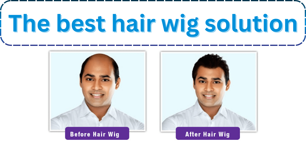 "before and after for wig user"
